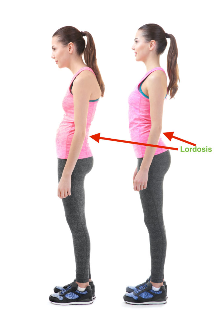 Standing lumbar lordosis